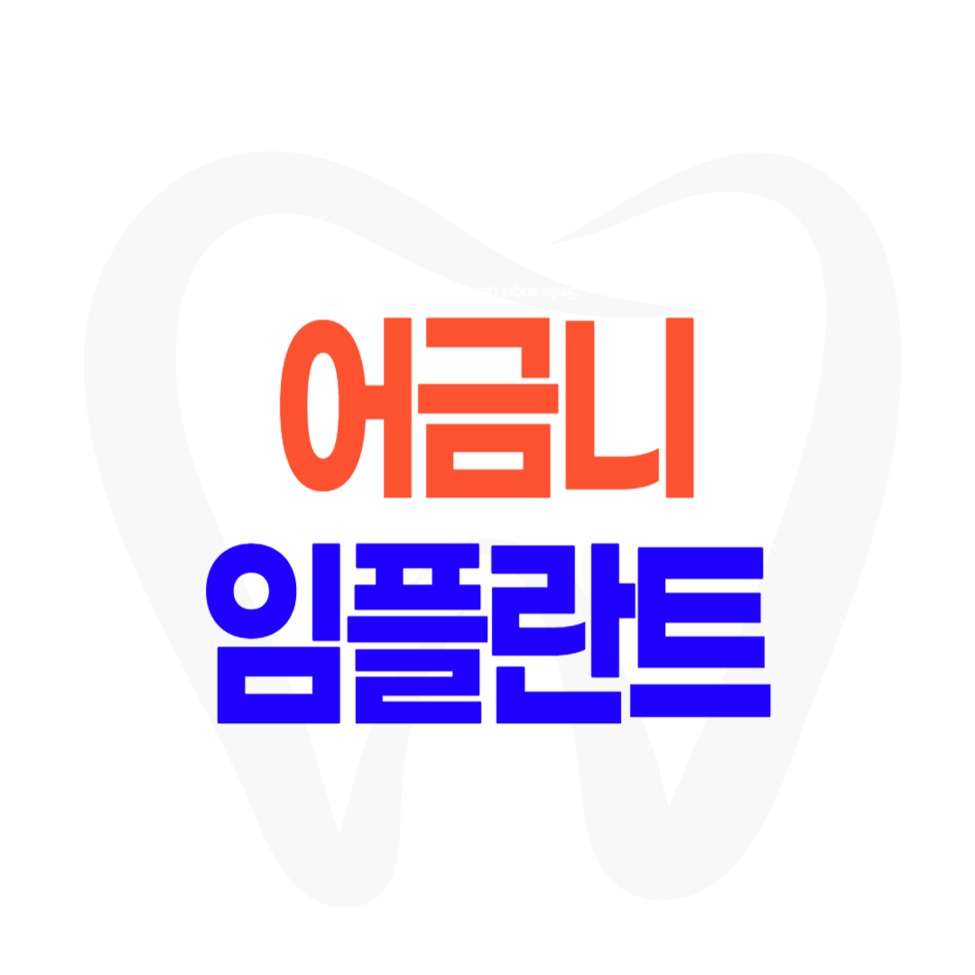 어금니 임플란트 가격 비용 주의사항 tip 3 건강보험 지르코니아 PFM