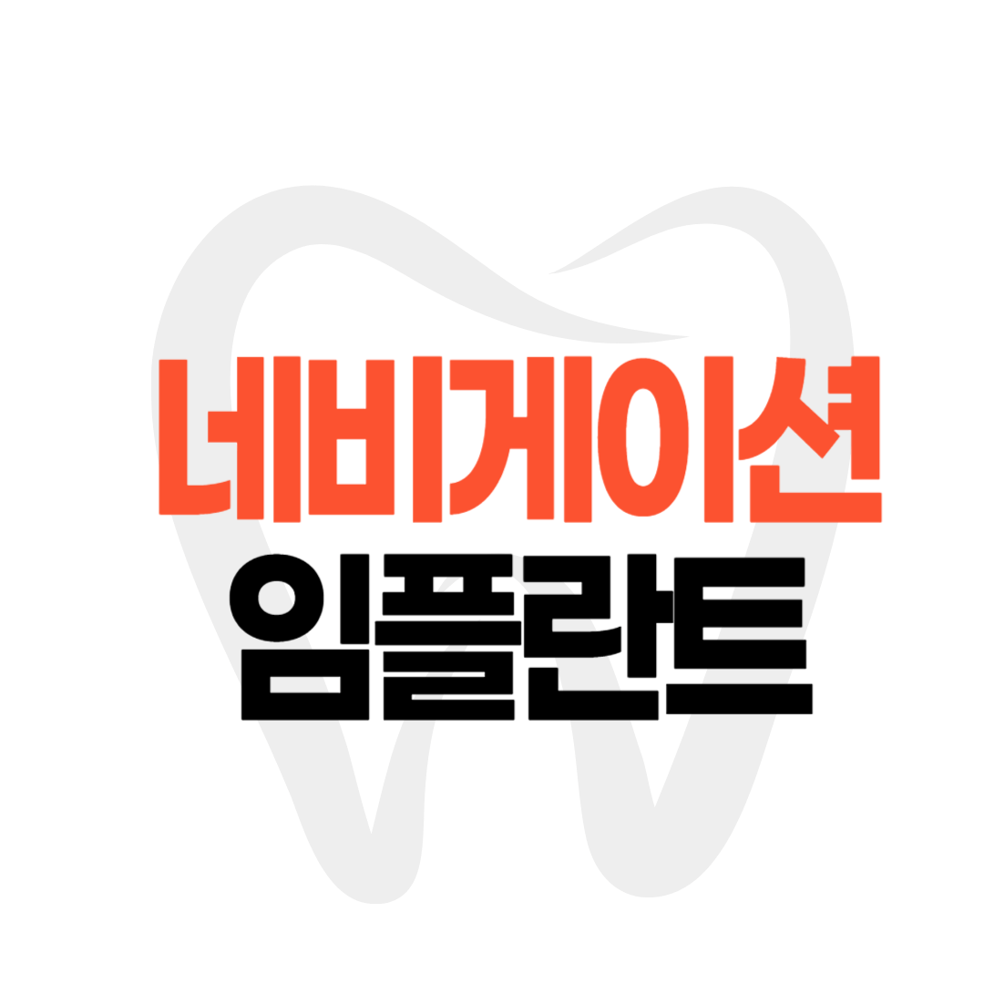 네비게이션 임플란트 장점