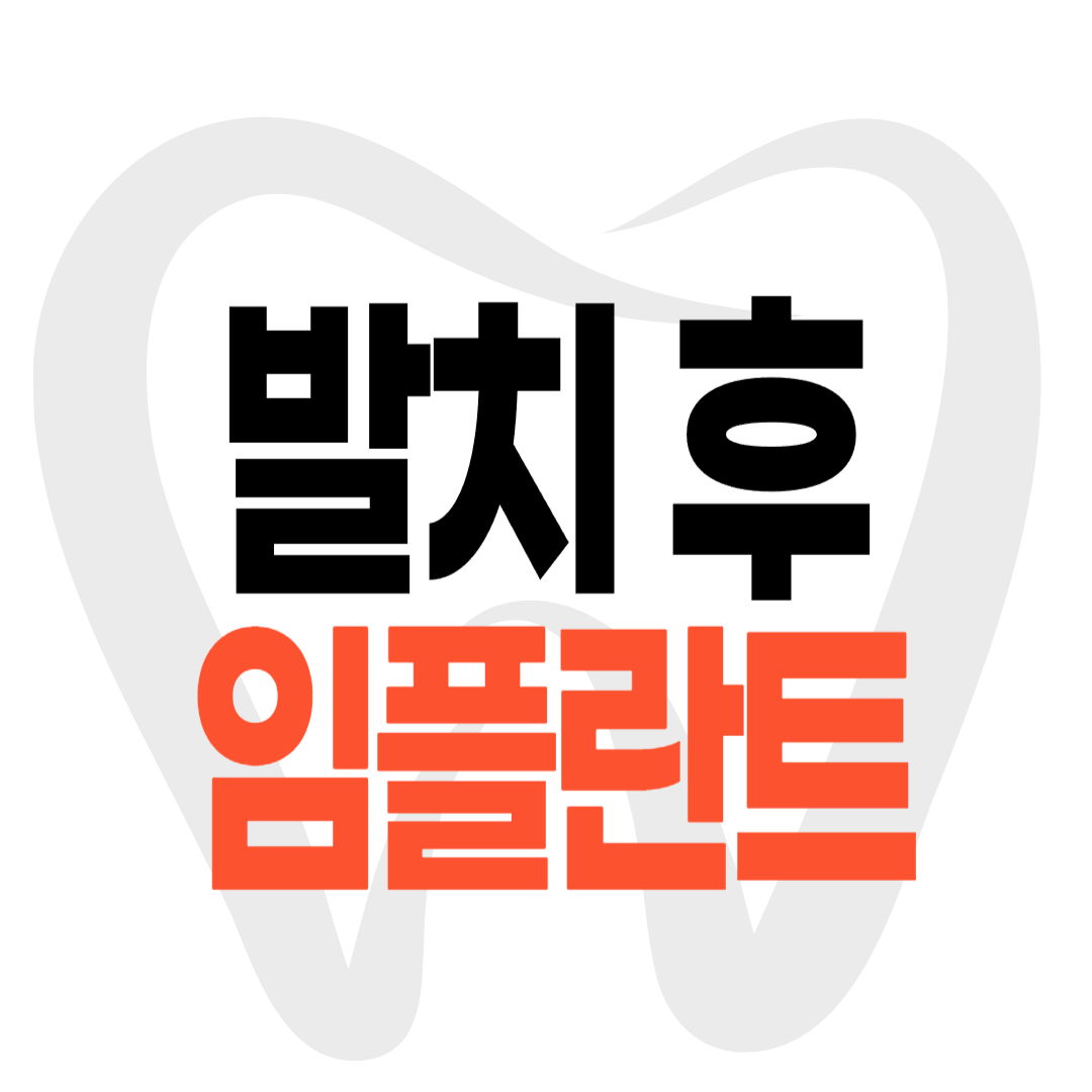 발치 후 임플란트